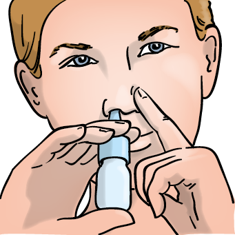 Kopfhaltung bei Nasensprays
